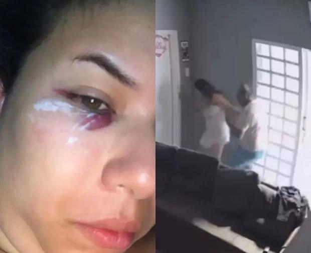 Jornalista denuncia sargento do Corpo de Bombeiros por violência doméstica;